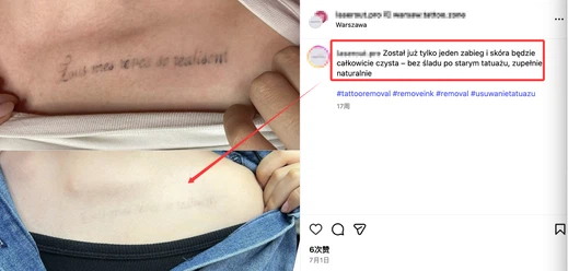 lQLPJwGBeUixgMPNA9zNCBSwtgcRIoRrDlAJC2uzHbh9AA2068988 lQLPJwGBeUixgMPNA9zNCBSwtgcRIoRrDlAJC2uzHbh9AA2068988